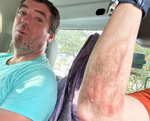 road-rash-mountain-biking-oaxaca-mexico